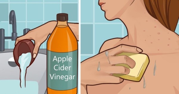 蘋果酒醋的好處