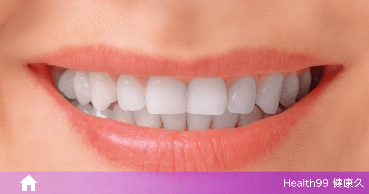 牙菌斑是什麼？