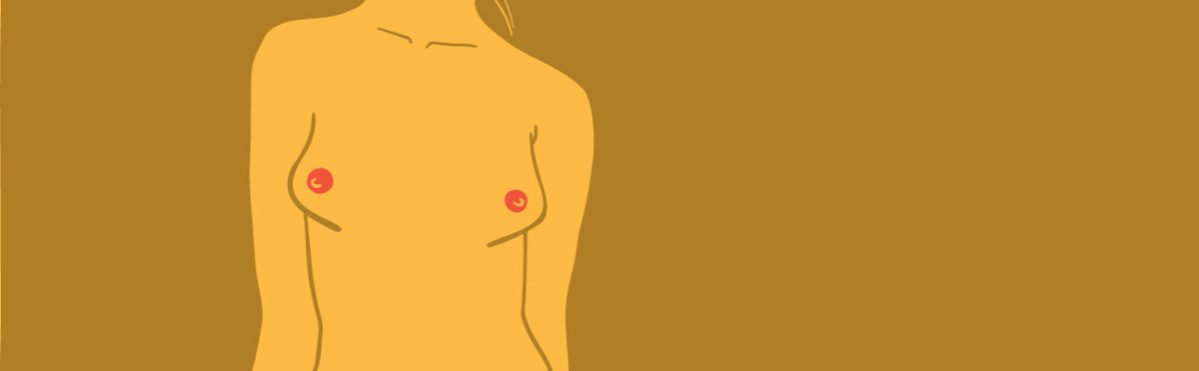 Common-Breast-Shapes-Conical